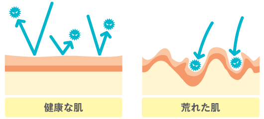 手荒れ対策